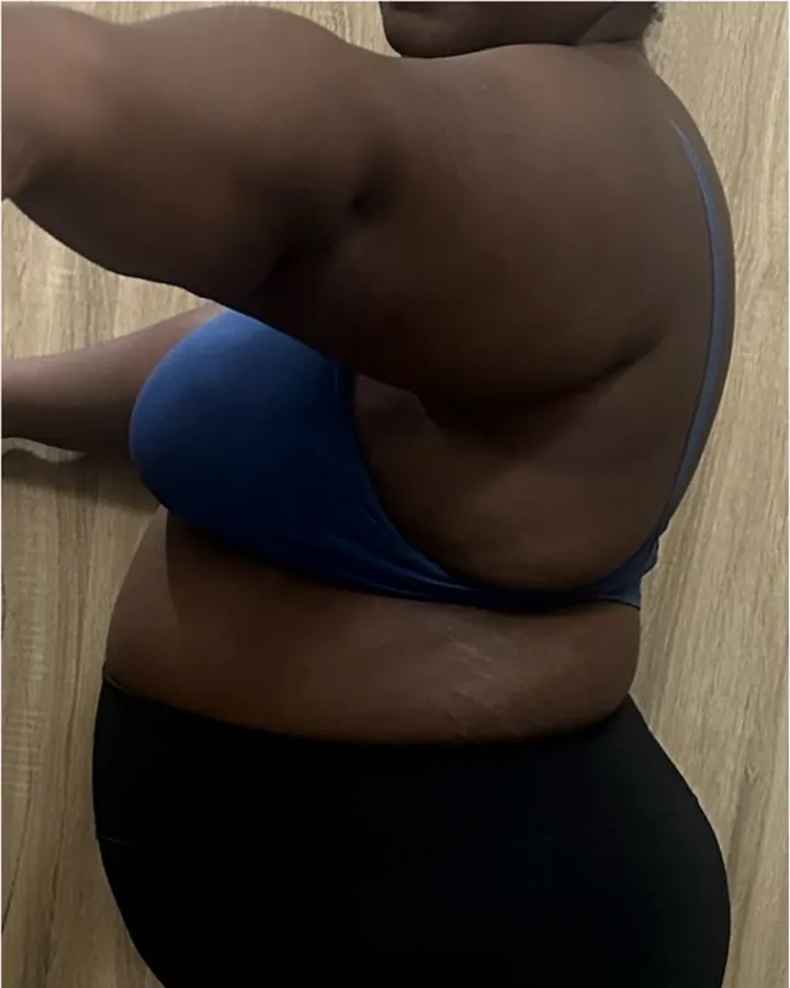 Before. Side-profile torso photographs of a client in a blue sports bra and black shorts, taken against the same wooden wall.