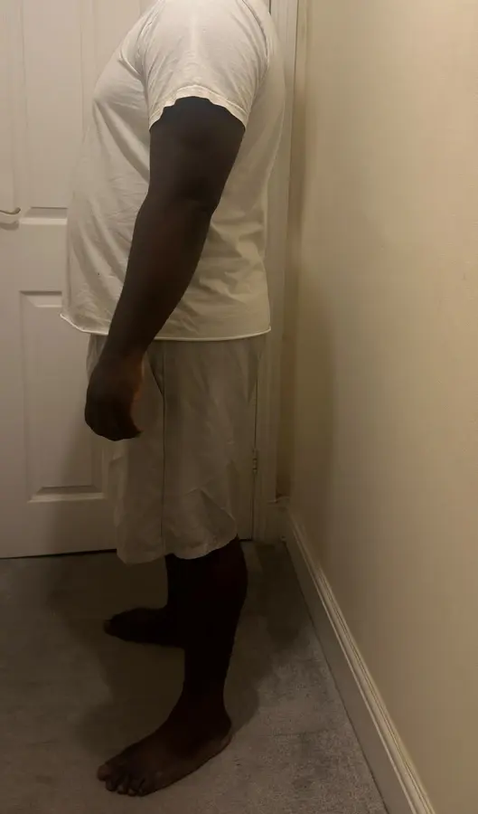 After. Torso photographs of a client, cropped below the jaw: standing side-on in a white T-shirt and cream shorts in a hallway, and the same clothes in the same hallway a month later.
