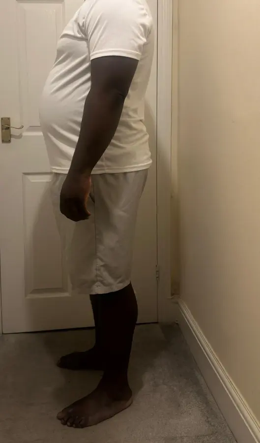Before. Torso photographs of a client, cropped below the jaw: standing side-on in a white T-shirt and cream shorts in a hallway, and the same clothes in the same hallway a month later.